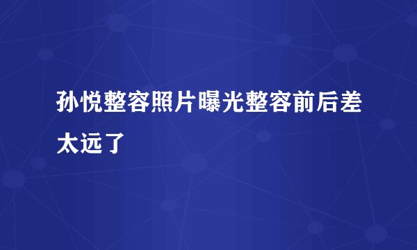孙悦整容照片曝光整容前后差太远了