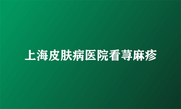 上海皮肤病医院看荨麻疹