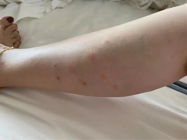 为什么有人建议旅游的时候不要住民宿?