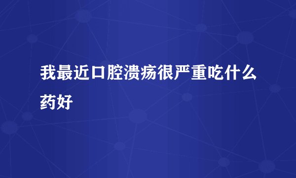 我最近口腔溃疡很严重吃什么药好