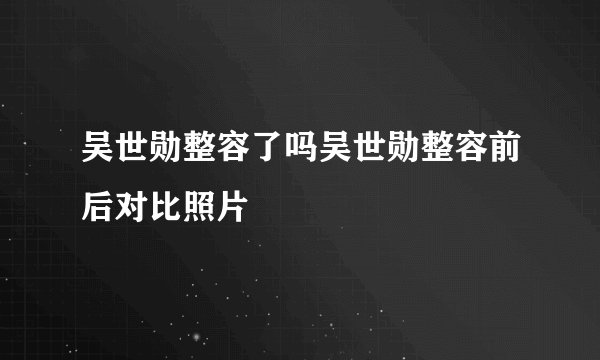 吴世勋整容了吗吴世勋整容前后对比照片