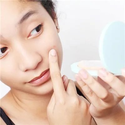青春痘的护理方法