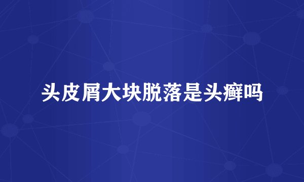 头皮屑大块脱落是头癣吗