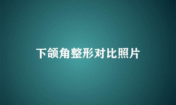 下颌角整形对比照片