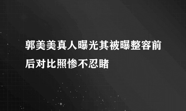 郭美美真人曝光其被曝整容前后对比照惨不忍睹