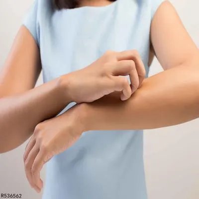 什么药可以根治牛皮癣