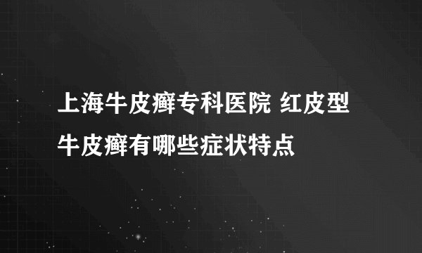 上海牛皮癣专科医院 红皮型牛皮癣有哪些症状特点