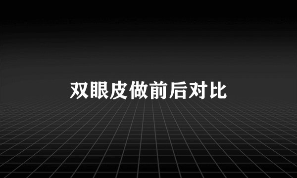双眼皮做前后对比