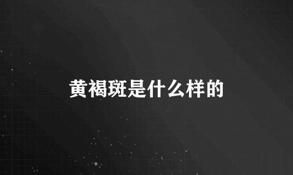 黄褐斑是什么样的