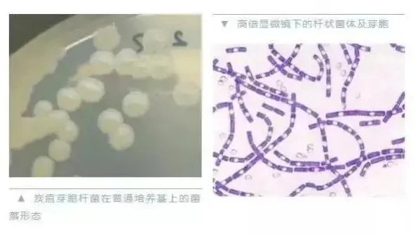 山东出现炭疽死亡病例!至少三地有人确诊,它是如何进行传播的?