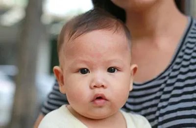 婴儿过敏性鼻炎怎么办