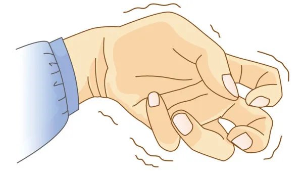 癫痫病吃什么药好