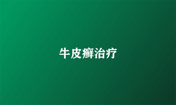 牛皮癣治疗